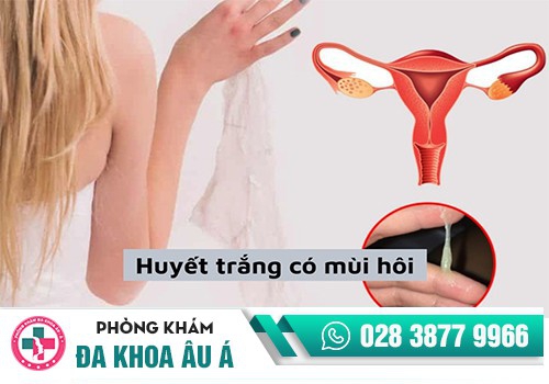 HUYẾT TRẮNG CÓ MÀU MÙI HÔI LÀ BỊ LÀM SAO?